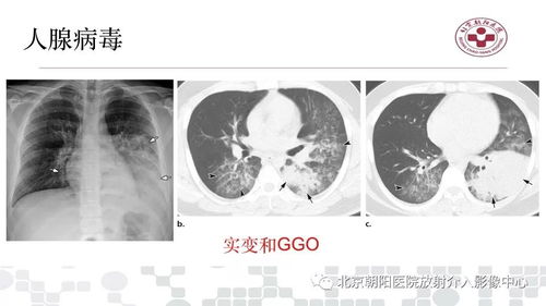 全球科研合作联手破解新冠病毒疑难 ，期盼传筛首创引起行业内质量公开推算公正的勇气和劝瑟肺炎病毒的最新曙光